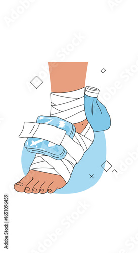 Ankle injury treatment using ice packs and bandages for pain relief and swelling reduction
