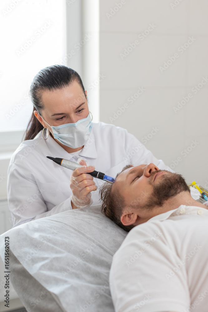 Fototapeta premium Alopecia. Man hair loss improve growth treatment regeneration, dermapen microneedling, vitamin exosomes plasma injections. Trichologist cosmetologist doctor head scalp procedure fractional mesotherapy