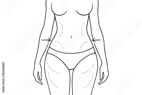 Anatomical drawing with dotted lines for liposuction body contouring, minimalistic healthcare design for fat reduction liposuction healthcare lineart