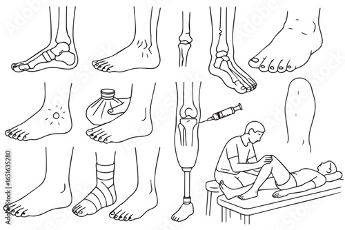 Lower limb medical diagram with foot injury, treatment, and rehabilitation illustrations, including fractures, prosthetics, and injections liposuction healthcare lineart