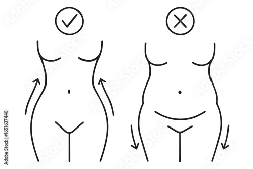 Illustration of torso body shapes, highlighting the ideal contours for cosmetic surgery and fat removal versus undesirable body shape liposuction healthcare lineart