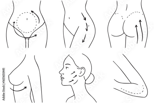 Anatomical sketches for body transformation, aesthetic treatments, contouring, beauty enhancement, facial and body surgery lineart transformative surgery lineart