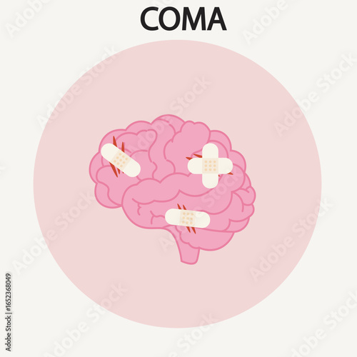Flat vector illustration of coma, damaged brain like unresponsiveness, no eye movement, and weak reflexes, with related conditions such as stroke and severe brain injury.