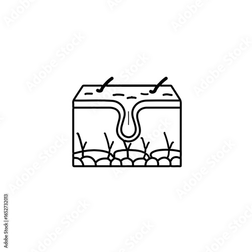 Detailed Schematic Illustration of Skin Layers and Hair Follicle Structure