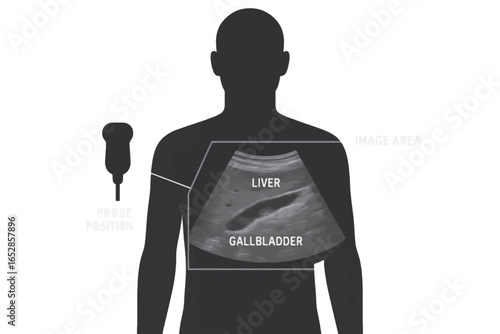 Vector concept of liver and gallbladder ultrasound image showing organ placement with silhouette and probe, useful for medical diagrams.