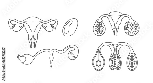 Diagrams of the female reproductive system, including the uterus, ovaries, and fallopian tubes.
