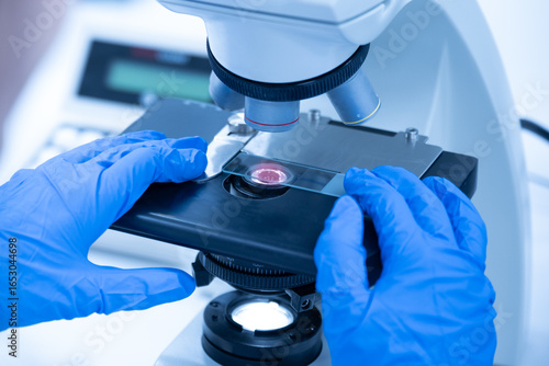 Asian women scientist looking to microscope eyepiece from CBC hematology slide in clinical laboratory.Medical technician analysis blood slide on exam plate microscopic at laboratory department.