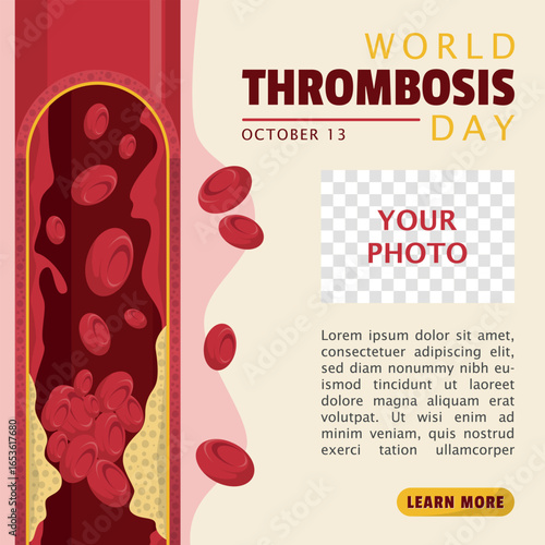 World Thrombosis Day Template. Blood clots in blood vessels