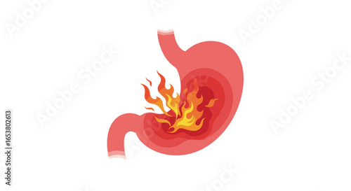 Understanding the causes symptoms and effective treatments for acid reflux and heartburn relief