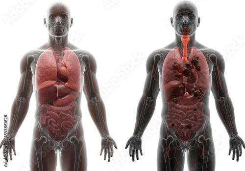 Comparison of healthy and diseased human respiratory systems, highlighting the effects of damage.