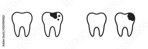Dental cavity illustrations representing tooth decay stages