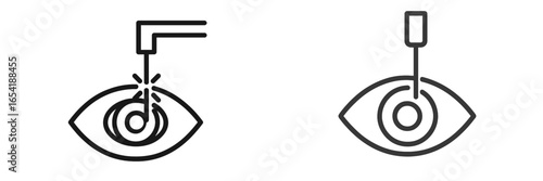 Illustration of laser treatment procedure for eye correction