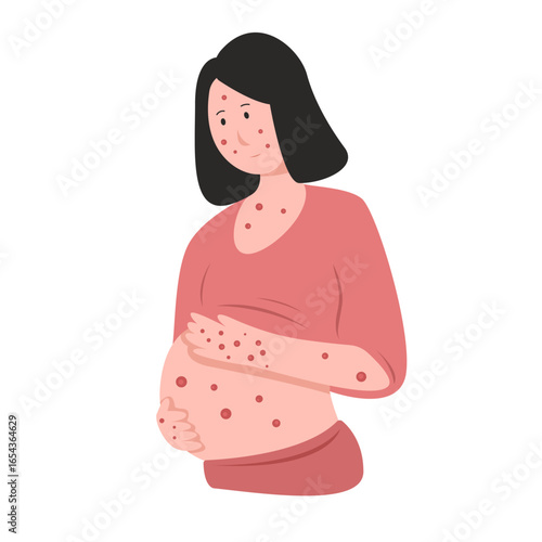 Foto syphilis symptoms. syphilis disease concept