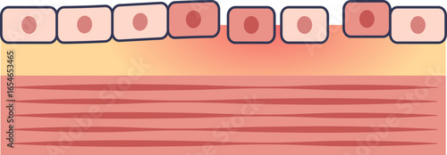 Medical diagram of endothelial injury. The damaged inner lining of a blood vessel shows disrupted endothelial cells, a key factor in cardiovascular disease and atherosclerosis.