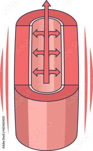 A diagram of a blood vessel cross-section with arrows showing blood flow and pressure against the artery walls, illustrating the concept of high blood pressure or hypertension.