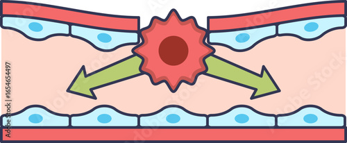 A diagram illustrating the intravasation process. A cancer cell is shown penetrating the endothelial wall of a blood vessel to enter the bloodstream, a critical step in metastasis.