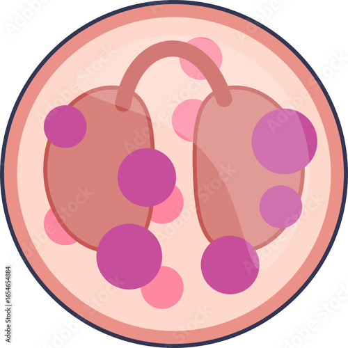 A vector illustration of a mature eosinophil, a type of granulocyte. It shows the characteristic bilobed nucleus and large eosinophilic granules within the cytoplasm. Represents immune response.