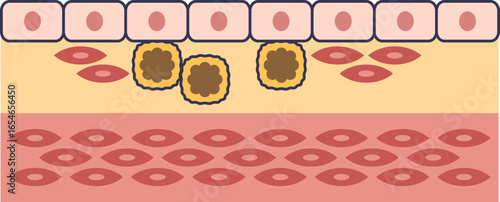 Diagram of smooth muscle cell migration in an artery wall. Shows endothelial layer, migrating SMCs, and foam cells in the intima, illustrating a key process in atherosclerosis development.
