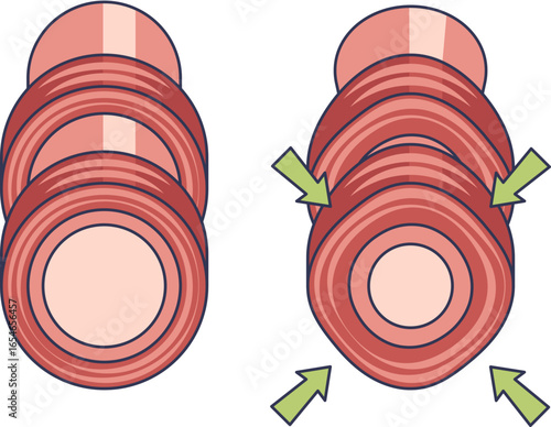 Diagram illustrating smooth muscle constriction. A relaxed tubular organ is compared to a constricted state, where muscle contraction, shown by arrows, narrows the lumen. Represents vasoconstriction.