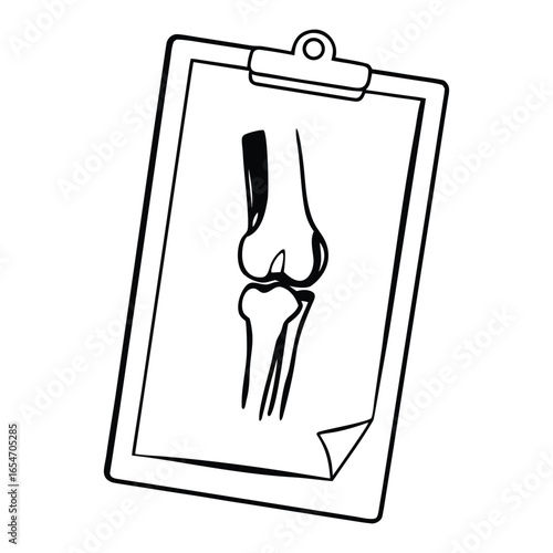 black and white knee x-ray on clipboard clip art preview