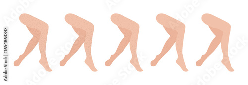 Hair removal stages showing smooth legs after shaving