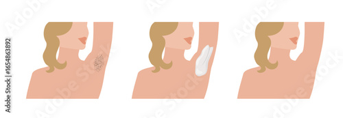 Woman applying depilatory cream for armpit hair removal