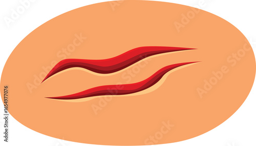 Red surgical wound is healing, showing scar tissue forming on skin