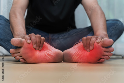 Papier peint Man holding painful feet with redness inflammation, symptom of foot pain, planta