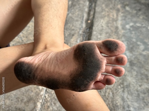 Canvas Print Barefoot with black dust on sole, concept of unclean and rough skin