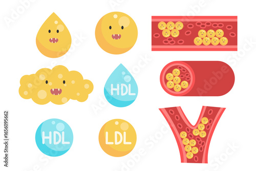 Cholesterol Buildup in Blood Vessel