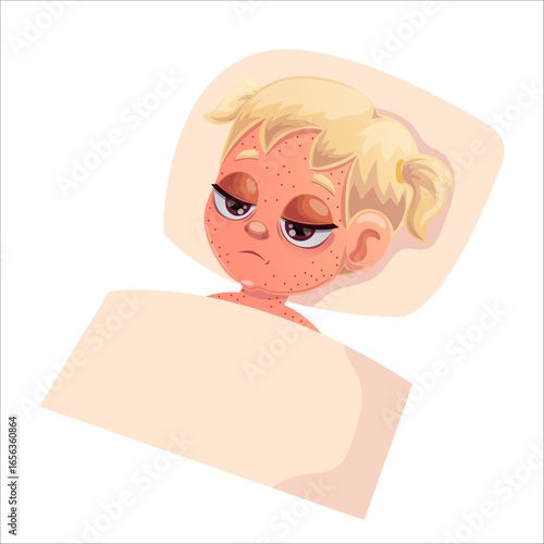 Vector illustration of a child with measles