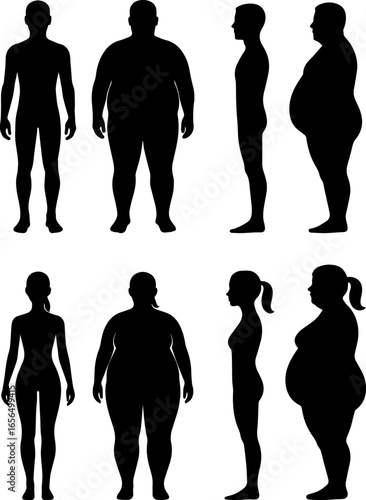 Minimal silhouette set comparing normal and obese body types for men and women, shown from front and side views. Ideal for health, fitness, BMI, and medical education or awareness materials