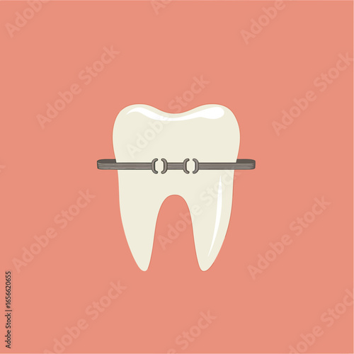 Single white molar tooth with metal braces wire isolated on plain peach-colored background flat vector dental orthodontics concept minimalistic design illustration