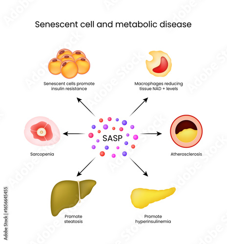 Senescent Cell and Metabolic Disease Pathways