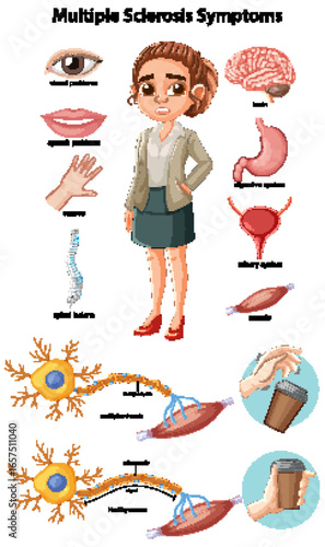 Vector Illustration of Multiple Sclerosis Symptoms and Effects