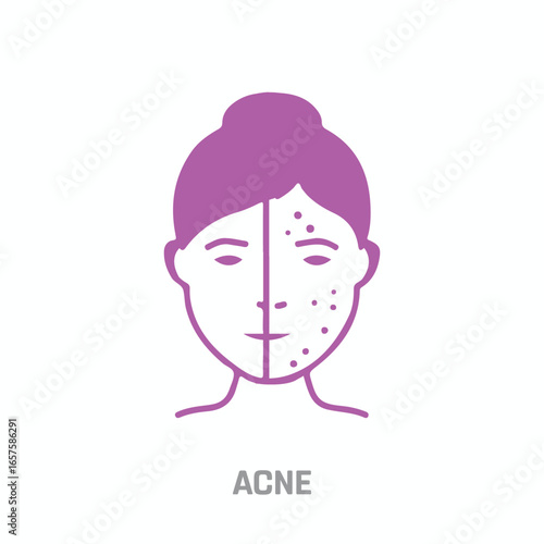 Hand-drawn icon of an Acne Face with a table on a white background