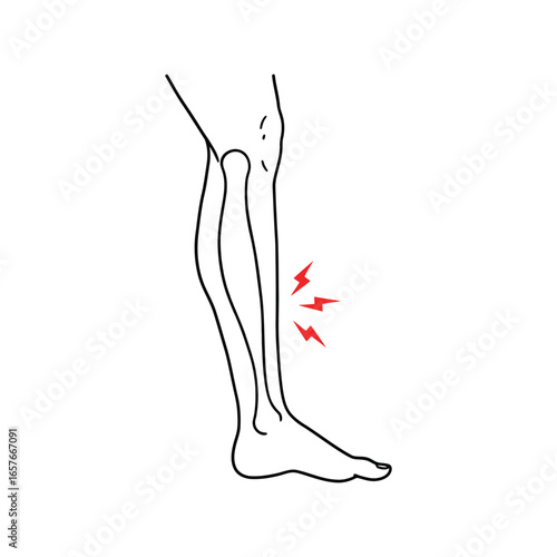 Human leg anatomy illustration shin bone pain muscle strain medical diagram skeletal system injury concept