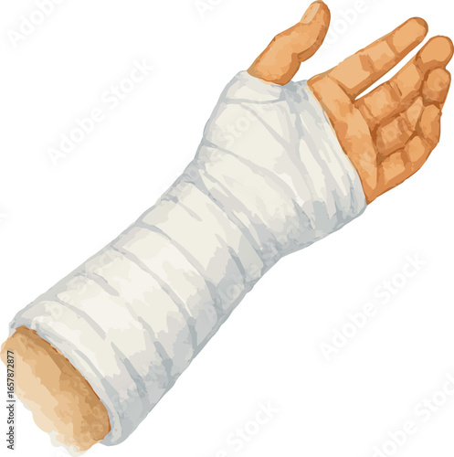 Watercolor vector painted wounded hand in cast