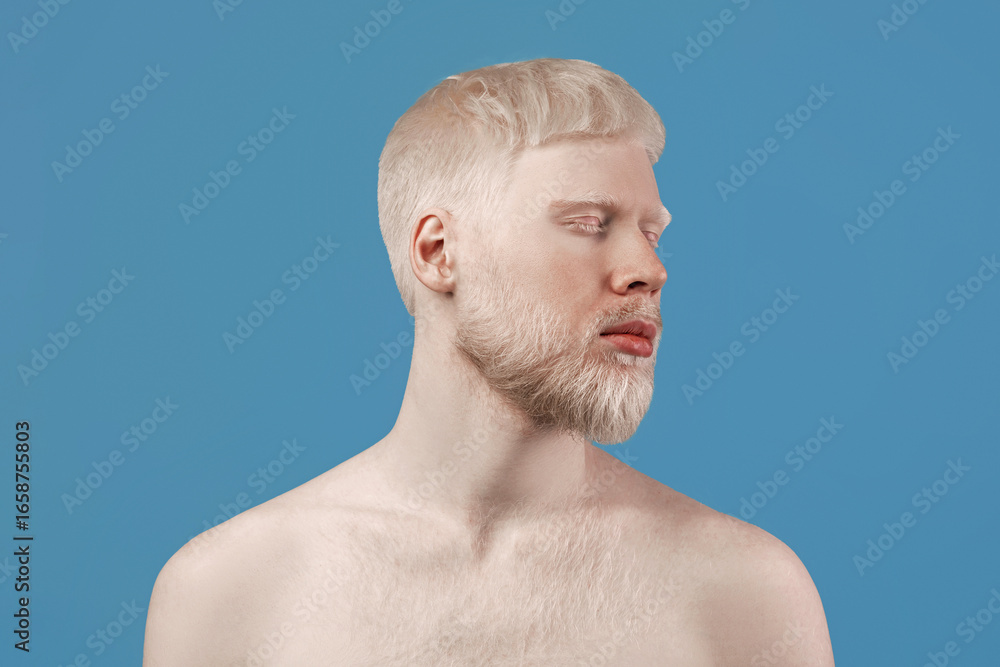 Obraz premium Uncommon appearance concept. Albino guy with naked shoulders posing over turquoise studio background. Bearded man turning head aside and close eyes. Albinism, skin abnormality