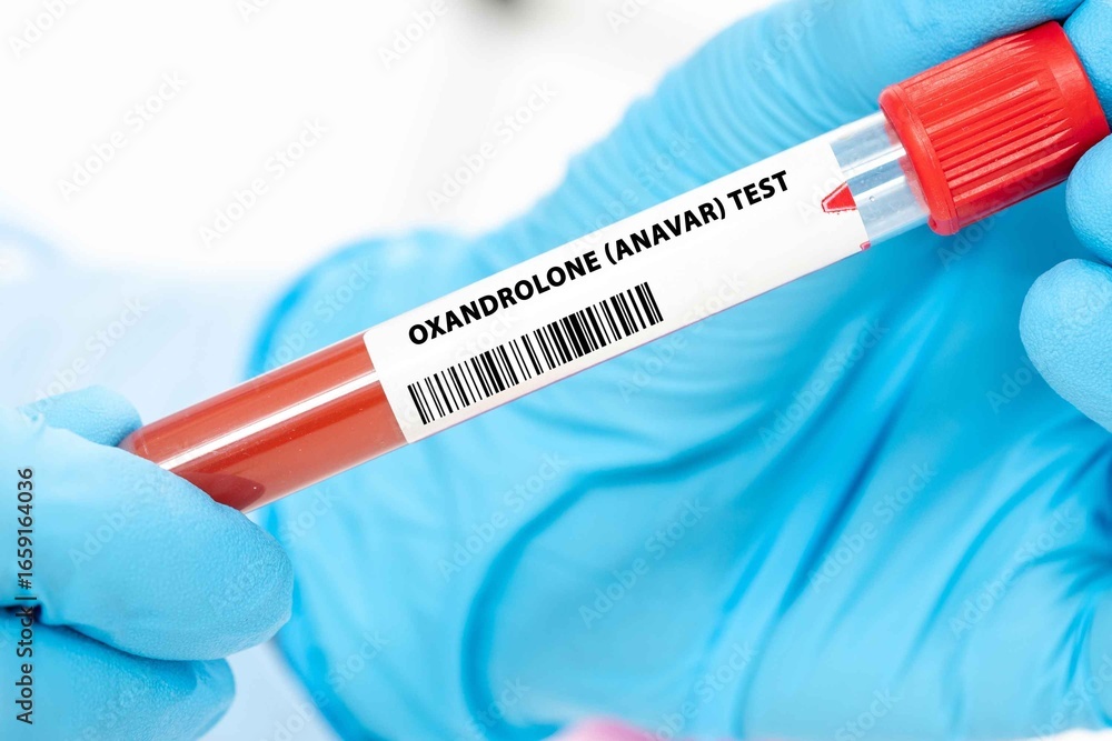 Fototapeta premium Oxandrolone (Anavar) Test