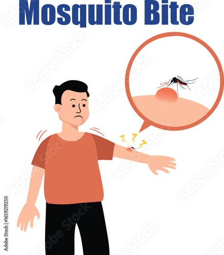 Macro Shot of Mosquito Bite Swelling on Human Body