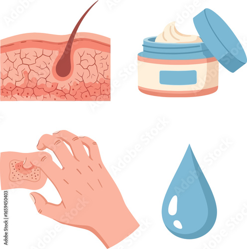 Skin care illustration showing skin conditions, hair follicles, and treatment.