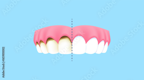 Upper teeth - Decay (Before and After Comparison) illustration vector design. Dental care concept.