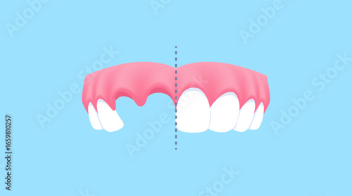 Upper teeth - Lost tooth (Before and After Comparison) illustration vector design. Dental care concept.