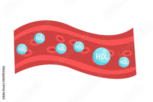 Cholesterol Buildup in Blood Vessel