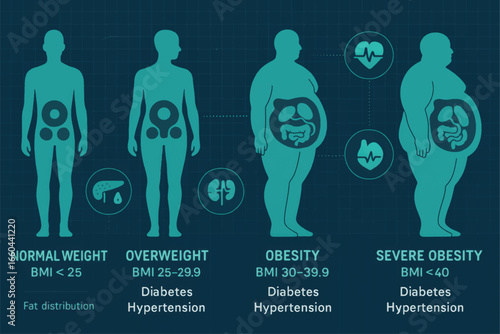 Vector infographic showing BMI categories and obesity stages with body silhouettes and internal organ icons for healthcare and educational use.