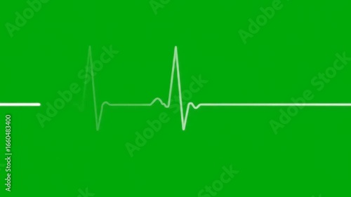 Wallpaper Mural Heartbeat EKG Green Background. Torontodigital.ca