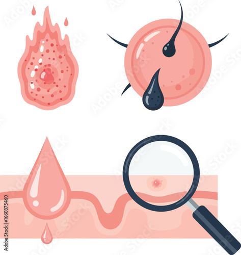Illustrative depiction of skin conditions, including inflammation, pores, and close-up analysis.