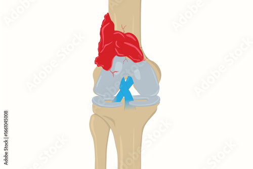 Human knee joint illustration showing bones, ligaments, muscles, and blood vessels anatomy. Eps 10
