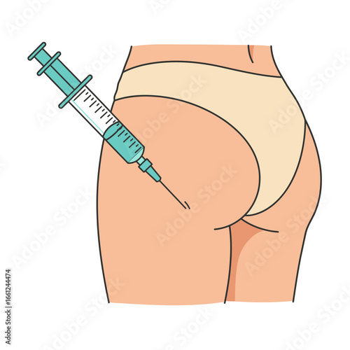 Medical Illustration of Buttocks Receiving Injection with Syringe.